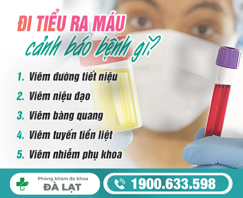 Hình ảnh minh họa